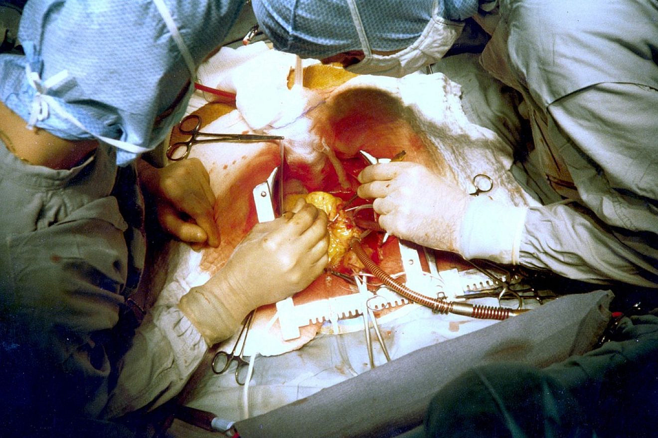 Heart surgery. Credit: Pixabay.