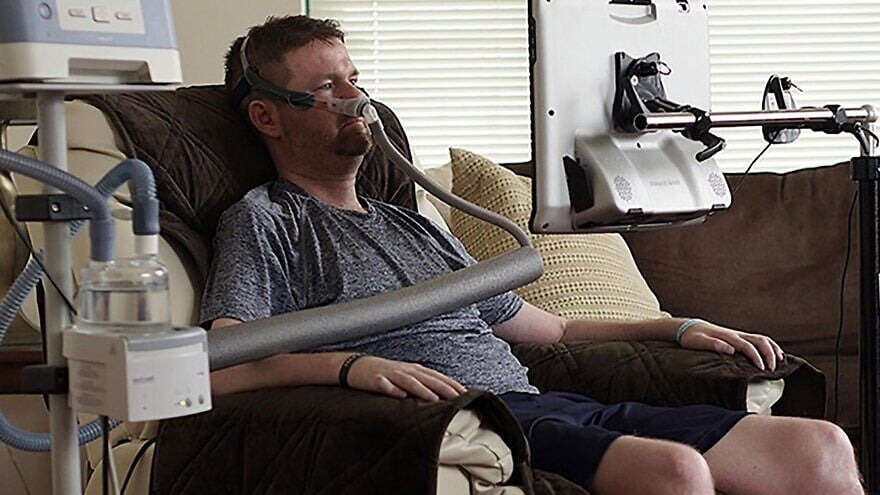 Amyotrophic lateral Sclerosis Amyotrophic lateral sclerosis-Causes-Diagnosis-Best treatment Options | Homeopathic | Best Homeopathic Doctor in Pakistan | Dr Qaisar Ahmed MD, DHMS