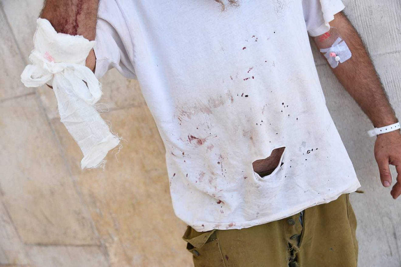 One of the wounded shepherds at Hadassah Medical Center-Mount Scopus in Jerusalem, Aug. 29, 2023. Photo by Yoav Dudkevitch/TPS.