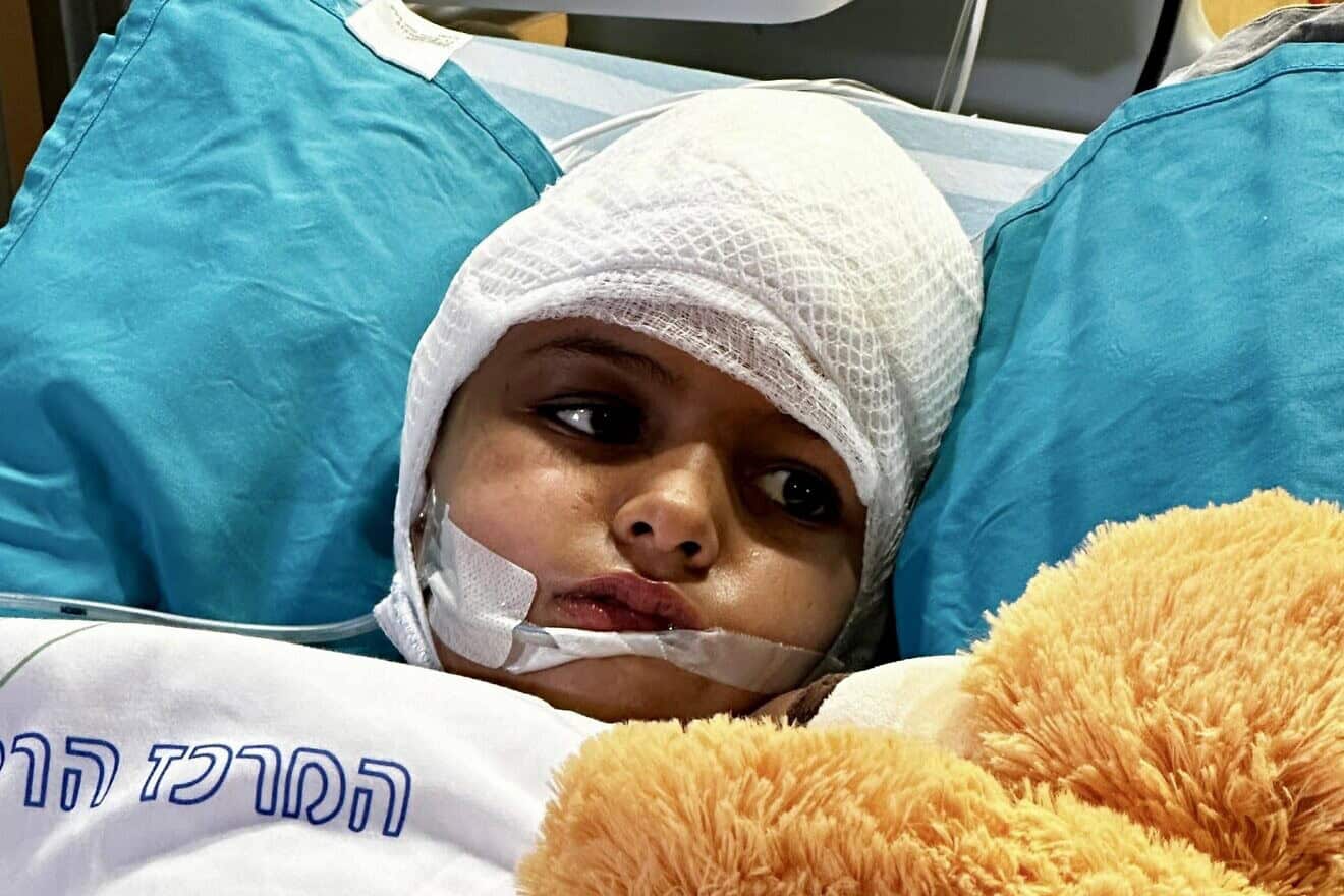 Amina Alhasoni, 7, was critically wounded in Iran's April 13, 2024, missile attack on the Jewish state. Credit: Courtesy.