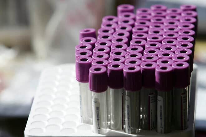 Test tubes for a blood test, illustrative. Photo by Kobi Gideon/Flash90.