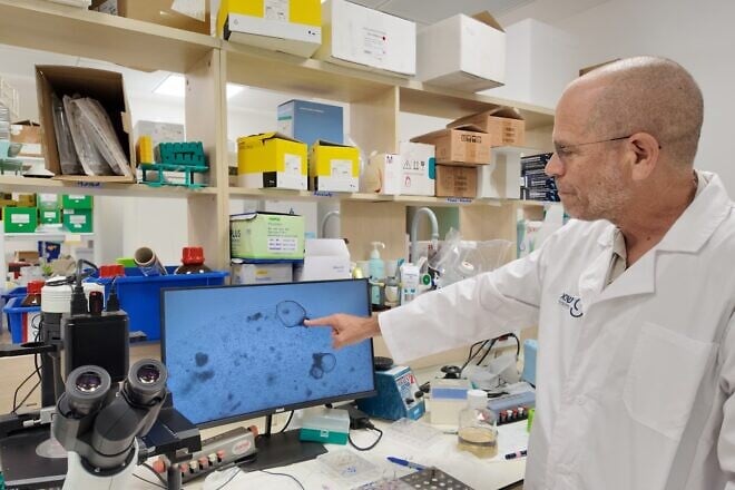 Professor Benjamin Dekel, director of the Pediatric Nephrology Unit at Safra Children's Hospital at Sheba Medical Center, and director of the Sagol Center for Regenerative Medicine at Tel Aviv University.